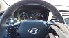 2015 Hyundai Sonata Limited Edition Scc Conditions Not Met